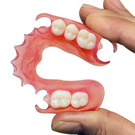 Partial Dentures